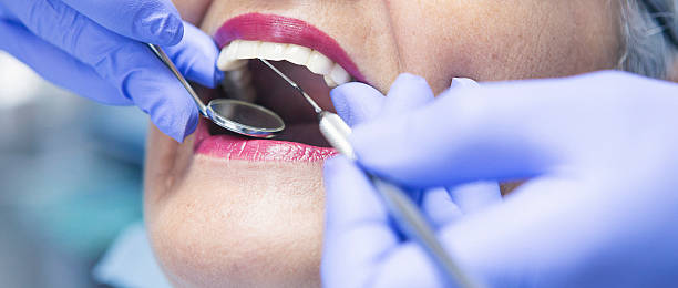 Best Emergency Dentist for Lost Fillings or Crowns in Presidential Lakes Estates, NJ
